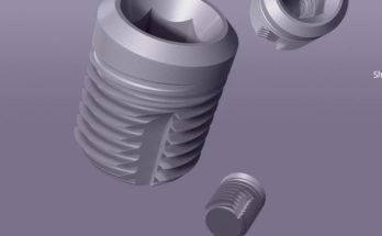 dental implant manufacturers