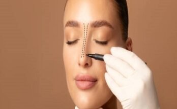 Rhinoplasty in Riyadh 7 (1)