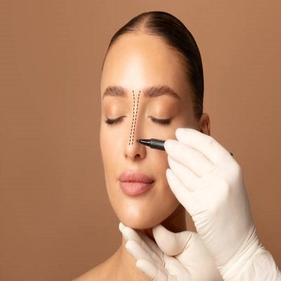 Rhinoplasty in Riyadh 7 (1)