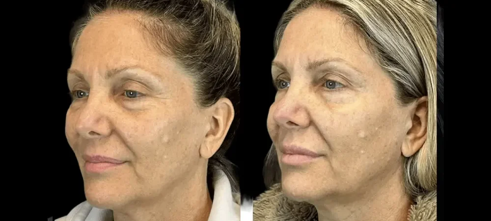 Best Aesthetic Clinic in Dubai