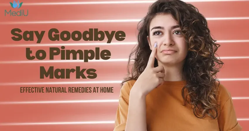 How to Get Rid of Pimple Marks at Home Naturally