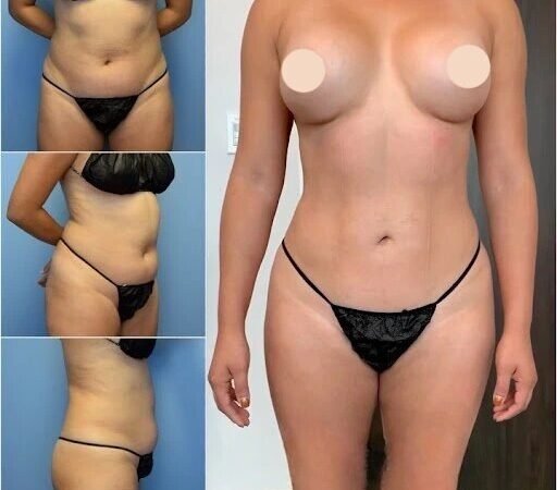 Body Contouring in Dubai