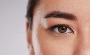 Upper blepharoplasty dubai