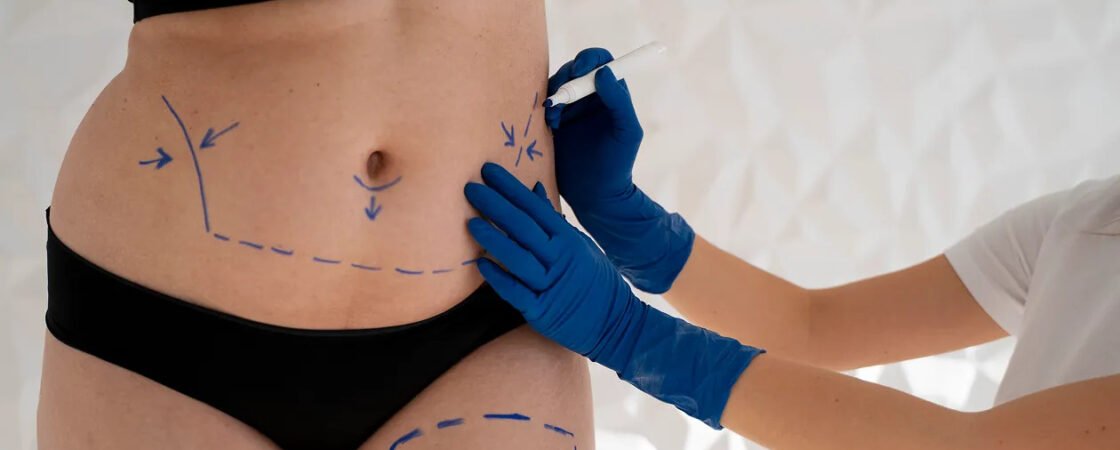 fat transfer in dubai,