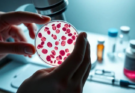 Blood Cancer Treatment: Modern Therapies and Survival Rates